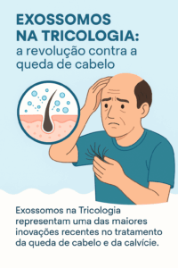 A tricologia vem evoluindo rapidamente e trazendo tecnologias inovadoras para o tratamento da alopecia androgenética, uma das principais causas da calvície tanto em homens quanto em mulheres. Entre essas novidades, os exossomos têm se destacado como uma das terapias mais promissoras no combate à queda de cabelo e no estímulo da regeneração capilar. O que são exossomos? Os exossomos são pequenas vesículas liberadas por células-tronco que carregam proteínas, fatores de crescimento e sinais biológicos capazes de estimular a regeneração tecidual. Na tricologia, eles funcionam como “mensageiros” que comunicam às células do folículo capilar para entrarem em processo de reparo e crescimento. Ou seja, quando aplicados no couro cabeludo, os exossomos ativam as células-tronco do folículo piloso, promovendo nascimento de novos fios, espessamento capilar e redução da inflamação local — algo essencial em casos de alopecia androgenética. Exossomos e alopecia androgenética A alopecia androgenética, também conhecida como calvície hereditária, está ligada à ação do hormônio DHT (derivado da testosterona), que enfraquece os folículos capilares, levando ao afinamento dos fios e, com o tempo, à aparência de careca. Enquanto tratamentos tradicionais, como o minoxidil e a finasterida, atuam de forma isolada, os exossomos oferecem uma abordagem mais completa: eles reduzem a inflamação, reativam folículos inativos e aumentam a vascularização local, criando um ambiente ideal para o crescimento capilar. Queda de cabelo: por que os exossomos são diferentes? Ação direta nas células-tronco do folículo piloso. Estímulo rápido de crescimento, com melhora visível em poucos meses. Tratamento unissex, eficaz em homens e mulheres. Mínimos efeitos colaterais, quando comparados a medicamentos tradicionais. Essas características tornam os exossomos uma alternativa inovadora não apenas para quem já sofre com a calvície, mas também para pessoas que estão nos estágios iniciais de queda de cabelo. Conclusão Os exossomos na tricologia representam uma das maiores evoluções recentes no tratamento capilar. Para quem enfrenta a alopecia androgenética, sofre com a calvície ou percebe os primeiros sinais de queda de cabelo, esta tecnologia pode ser a chave para recuperar a autoestima e conquistar fios mais fortes e saudáveis.